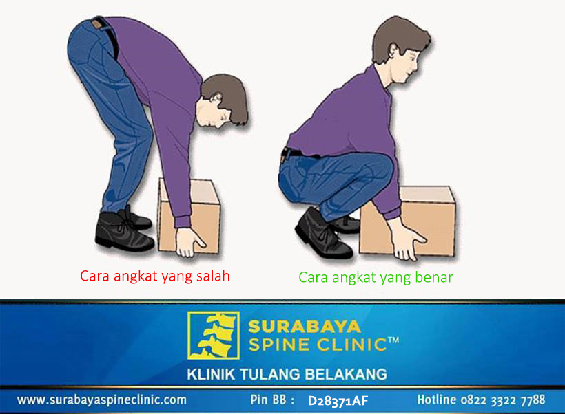 Mencegah Nyeri Punggung dengan Cara Mengangkat yang Benar